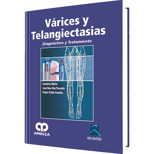 Varices y Telangiectasias-amolca-UNIVERSAL BOOKS
