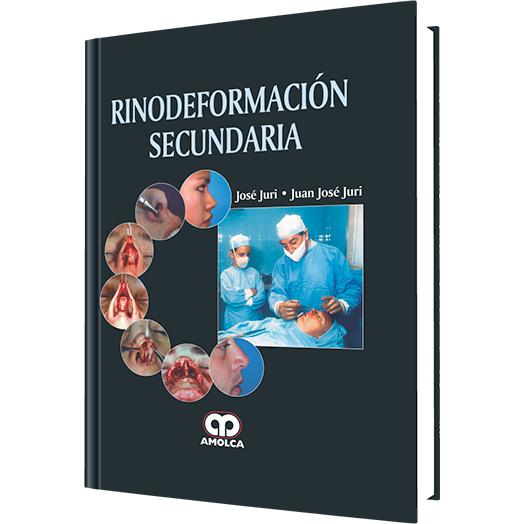 Rinodeformacion Secundaria-REVISION - 27/01-amolca-UNIVERSAL BOOKS