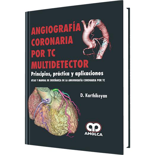 Angiografia Coronaria por TC - Multidetector-REVISION - 20/01-amolca-UNIVERSAL BOOKS