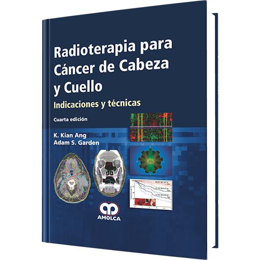 Radioterapia para Cancer de Cabeza y Cuello-amolca-UNIVERSAL BOOKS