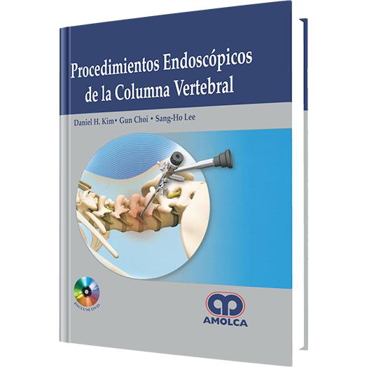 Procedimientos Endoscopicos de la Columna-REVISION - 27/01-amolca-UNIVERSAL BOOKS