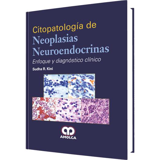 Citopatologia de Neoplasias Neuroendocrinas Enfoque y diagnostico clinico-REVISION - 24/01-amolca-UNIVERSAL BOOKS