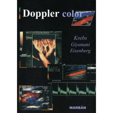 DOPPLER COLOR-MARBAN-UNIVERSAL BOOKS