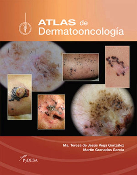 Atlas de Dermatooncología