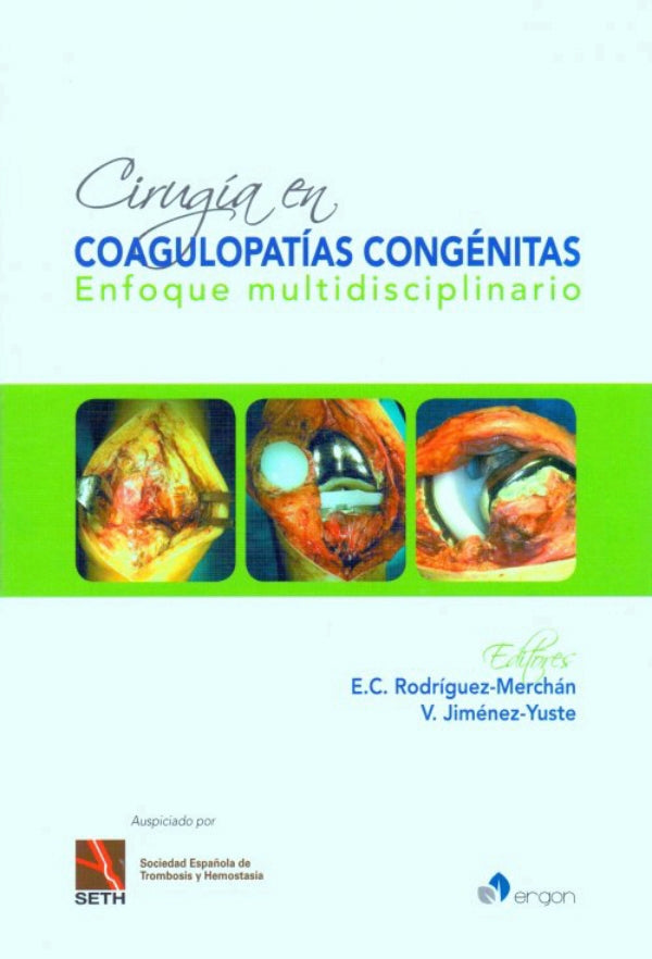 Cirugía en coagulopatías congénitas enfoque multidisciplinario