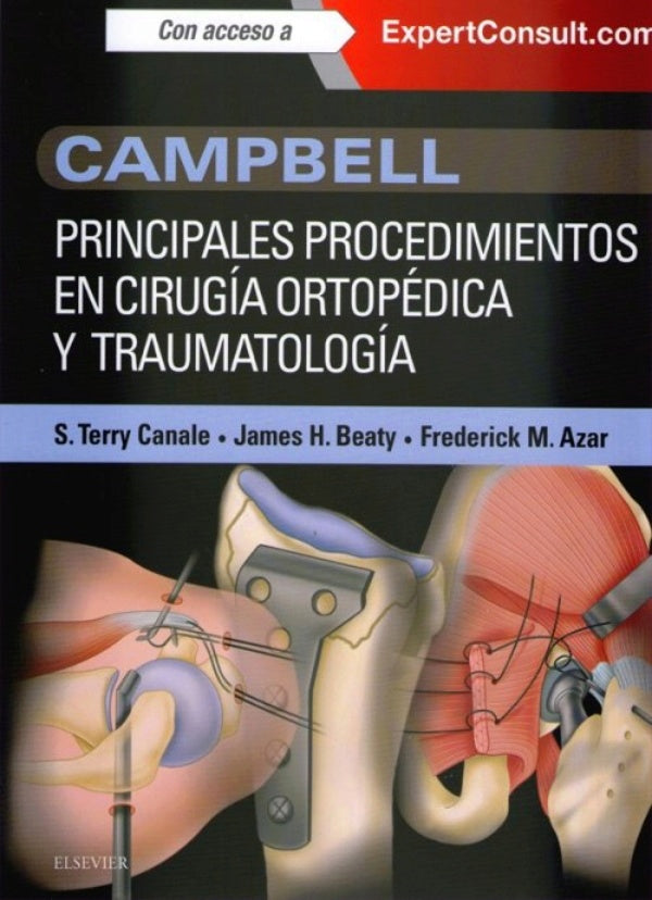 link Campbell. Principales procedimientos en cirugía ortopédica y traumatología