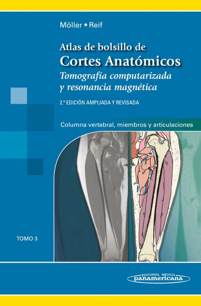 Atlas de Bolsillo de Cortes Anatómicos. Tomo 3. Tomografía computarizada y resonancia magnética: Columna vertebral, Miembros y A