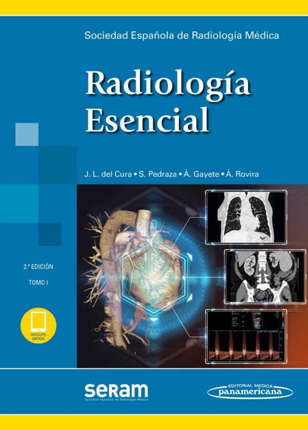 SERAM. Radiología Esencial 2 Tomos
