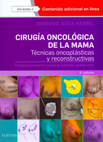Cirugía oncológica de la mama: Técnicas oncoplásticas y reconstructivas