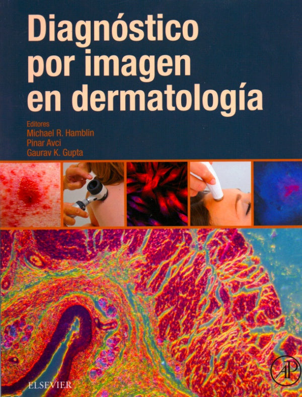 Diagnóstico por imagen en dermatología