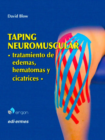 Taping neuromuscular. Tratamiento de edemas, hematomas y cicatrices
