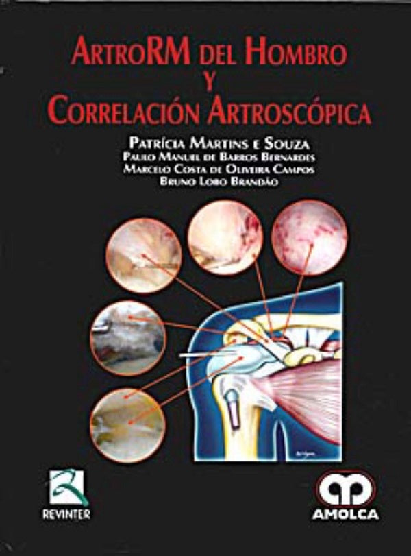 ArtroRM del hombro y correlación artroscópica