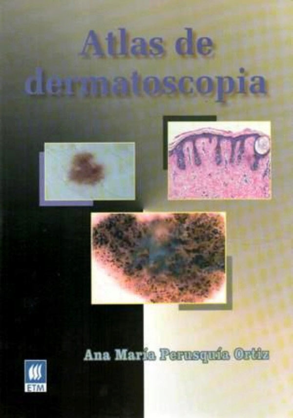 Atlas de dermatoscopia