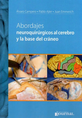 Abordajes Neuroquirurgicos al Cerebro y la Base del Craneo