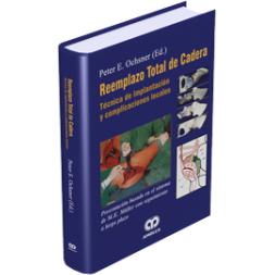 Reemplazo Total de Cadera-amolca-UNIVERSAL BOOKS