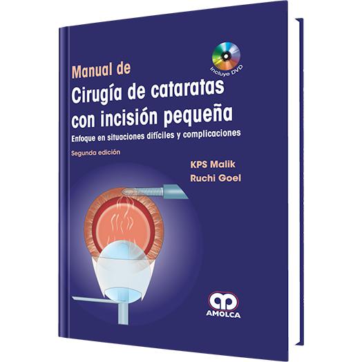 Manual de Cirugia de Cataratas con Incision Pequeña-amolca-UNIVERSAL BOOKS