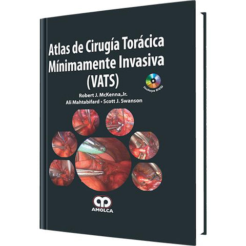 Atlas de Cirugia Toracica Minimamente Invasiva (VATS)-REVISION - 20/01-amolca-UNIVERSAL BOOKS