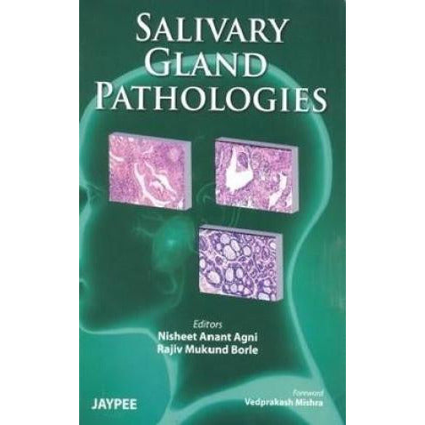 Salivary Gland Pathologies-REVISION - 26/01-jayppe-UNIVERSAL BOOKS