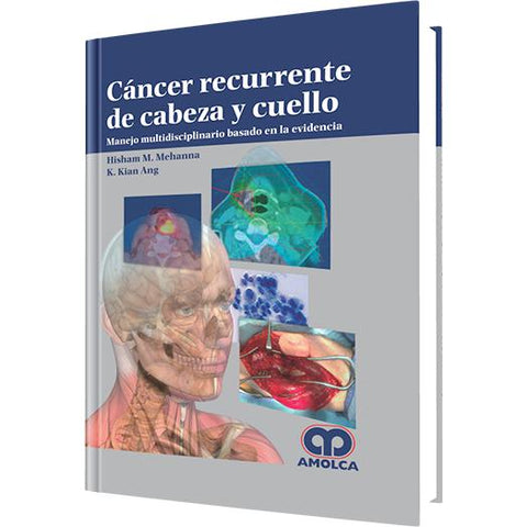 Cancer Recurrente de Cabeza y Cuello-amolca-UNIVERSAL BOOKS
