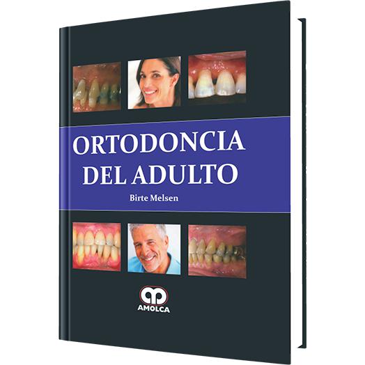 Ortodoncia del Adulto-amolca-UNIVERSAL BOOKS