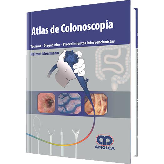 Atlas de Colonoscopia - Tecnicas – Diagnostico – Procedimientos Intervencionistas-amolca-UNIVERSAL BOOKS
