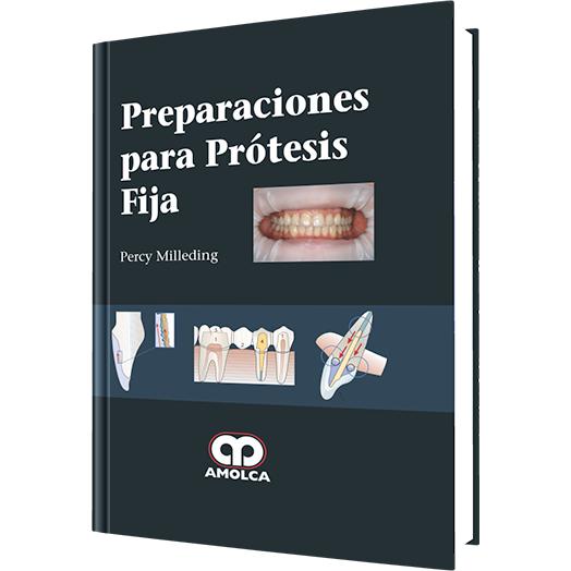 Preparaciones para Protesis Fija-amolca-UNIVERSAL BOOKS