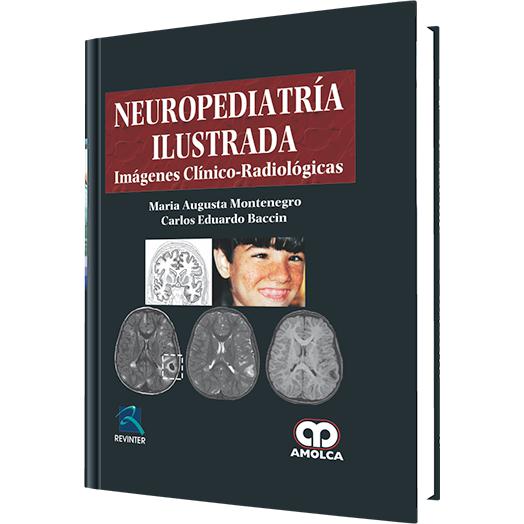 Neuropediatria Ilustrada Imagenes Clinico-radiologicas-amolca-UNIVERSAL BOOKS