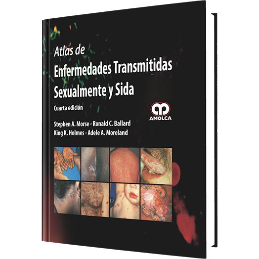 Atlas de Enfermedades Transmitidas Sexualmente y SIDA - 4 Edicion.-amolca-UNIVERSAL BOOKS