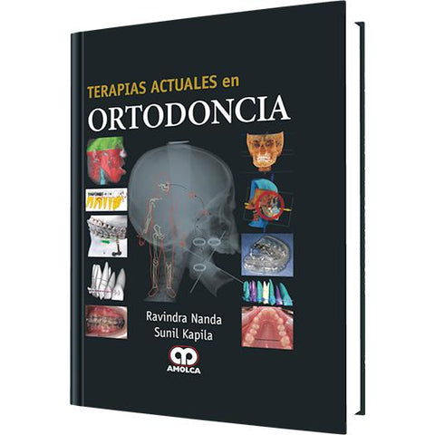 Terapias Actuales en Ortodoncia-amolca-UNIVERSAL BOOKS