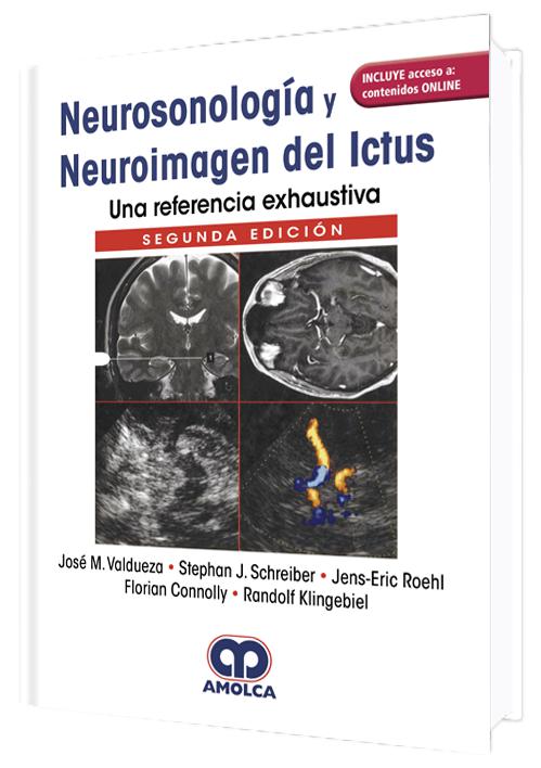 NEUROSONOLOGIA Y NEUROIMAGEN DEL ICTUS, 2 EDICION-UNIVERSAL BOOKS-UNIVERSAL BOOKS