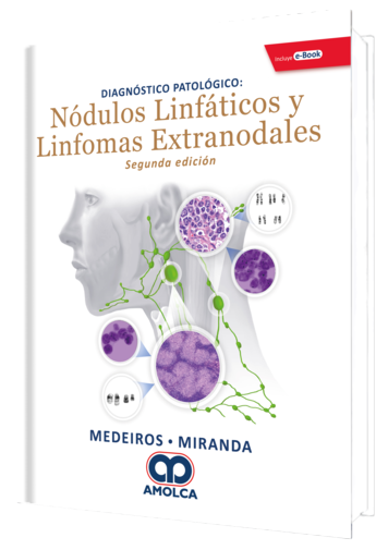 Diagnostico Patologico: Nodulos Linfaticos y Linformas Extranodales 2 Edicion