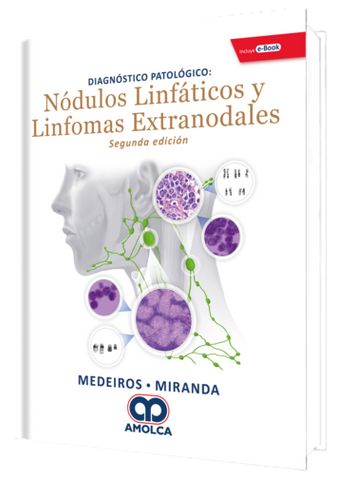 Diagnostico Patologico: Nodulos Linfaticos y Linformas Extranodales 2 Edicion