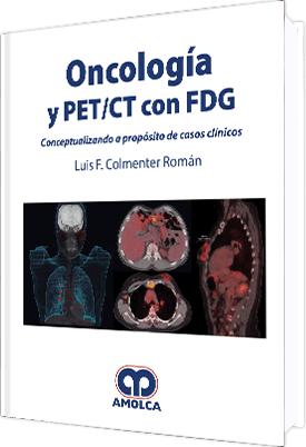 Oncología y PET/CT con FDG Conceptualizando a propósito de casos clínicos-UNIVERSAL BOOKS-UNIVERSAL BOOKS
