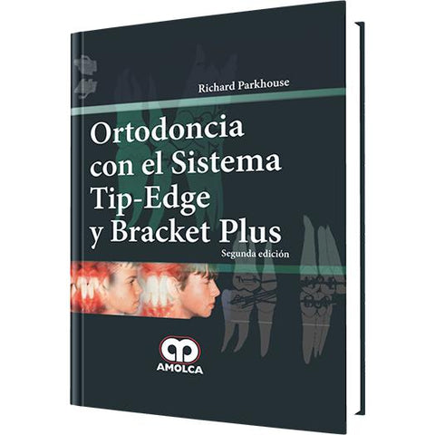 Ortodoncia con el Sistema Tip - Edge y Bracket Plus-REVISION - 30/01-amolca-UNIVERSAL BOOKS