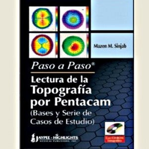 PASO A PASO LECTURA DE LA TOPOGRAFIA POR PENTACAM (BASES Y SERIE DE CASOS DE ESTUDIO) -Sinjab-REVISION - 30/01-jayppe-UNIVERSAL BOOKS