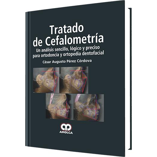 Tratado de Cefalometria, un Analisis Sencillo, Logico y Preciso-REVISION - 25/01-amolca-UNIVERSAL BOOKS