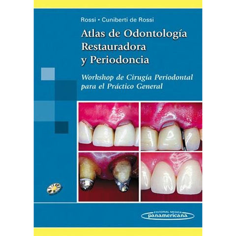 Atlas de Odontologia Restauradora y Periodoncia. Workshop de cirugia periodontal para el practico general. Incluye CD-ROM-panamericana-UNIVERSAL BOOKS