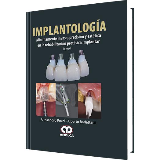 Implantologia Minimamente Invasiva, Precision y Estetica (2 tomos)-amolca-UNIVERSAL BOOKS