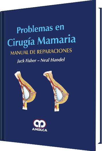 Problemas en Cirugía Mamaria Manual de reparaciones-UNIVERSAL BOOKS-UNIVERSAL BOOKS