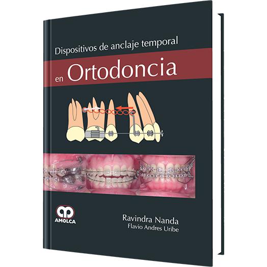 Dispositivos de Anclaje Temporal en Ortodoncia-amolca-UNIVERSAL BOOKS