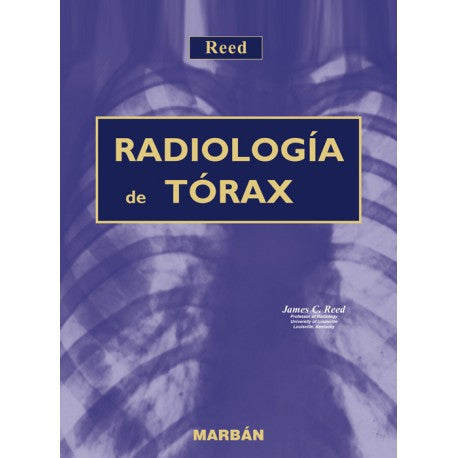 RADIOLOGÍA DEL TÓRAX T.D. Gran Formato-MARBAN-UNIVERSAL BOOKS
