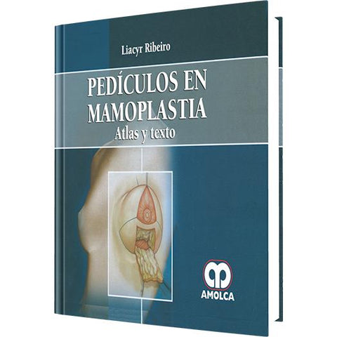 Pediculos en Mamoplastia-REVISION - 30/01-amolca-UNIVERSAL BOOKS
