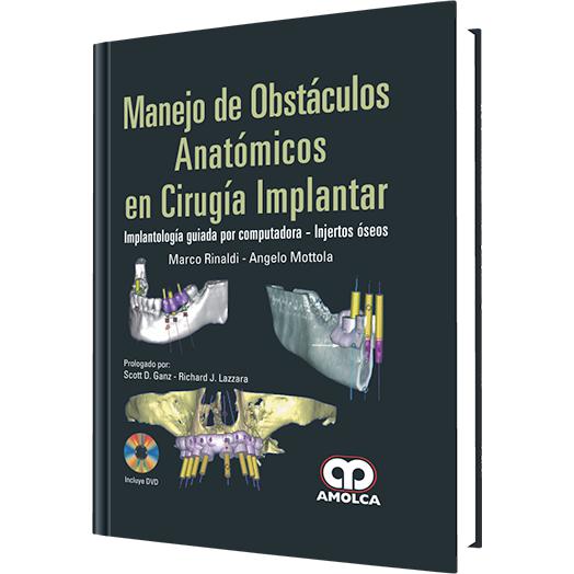 Manejo de Obstaculos Anatomicos en Cirugia Implantar-amolca-UNIVERSAL BOOKS