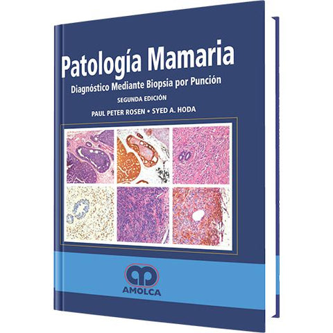 Diagnostico - Patologia Mamaria-amolca-UNIVERSAL BOOKS