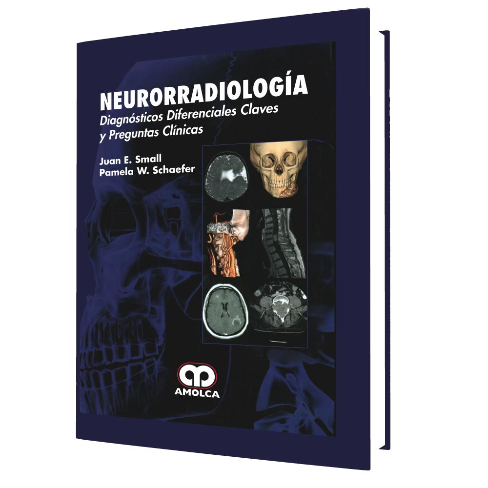 Neurorradiologia. Diagnostico diferenciales, claves y preguntas-amolca-UNIVERSAL BOOKS