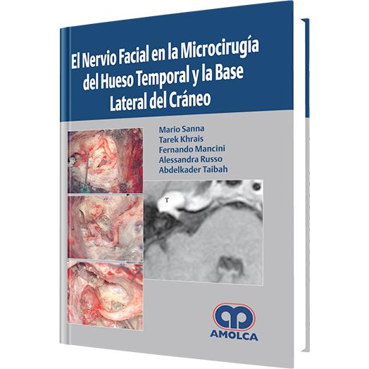 El Nervio Facial, Microcirugia-amolca-UNIVERSAL BOOKS