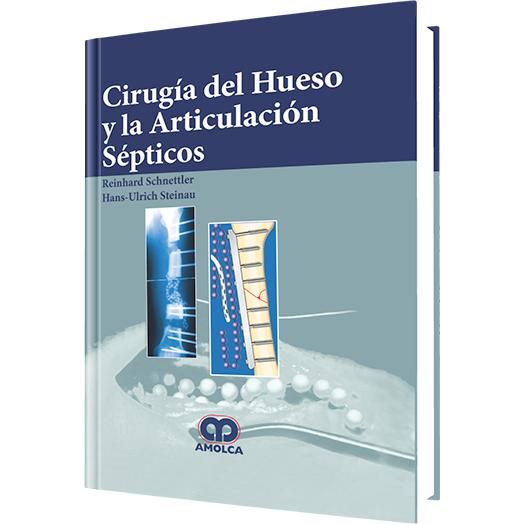 Cirugia del Hueso y la Articulacion Septicos-REVISION - 24/01-amolca-UNIVERSAL BOOKS