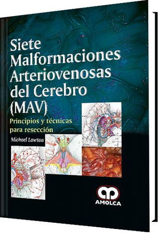 Siete Malformaciones Arteriovenosas del Cerebro (MAV) – Principios y técnicas para resección-UNIVERSAL BOOKS-UNIVERSAL BOOKS