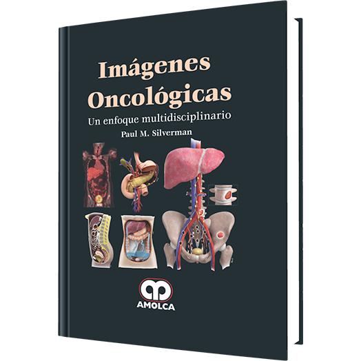 Imagenes Oncologicas Un enfoque multidisciplinario-amolca-UNIVERSAL BOOKS