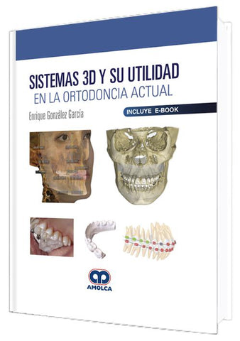 SISTEMAS 3D Y SU UTILIDAD EN LA ORTODONCIA ACTUAL-UNIVERSAL BOOKS-UNIVERSAL BOOKS